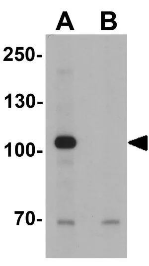 WB analysis of mouse brain tissue lysate in (A) the absence and (B) the presence of blocking peptide using GTX17216 USP25 antibody. Working concentration : 1 microg/ml WB analysis of mouse brain tissue lysate in (A) the absence and (B) the presence of blocking peptide using GTX17216 USP25 antibody. Working concentration : 1 microg/ml