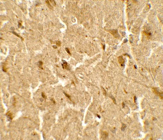 IHC-P analysis of human brain tissue using GTX17216 USP25 antibody. Working concentration : 5 microg/ml