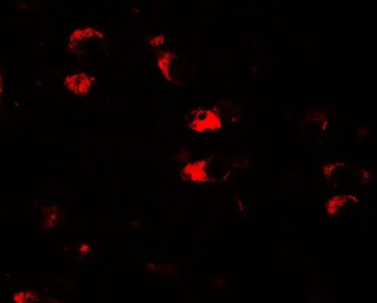 IHC-P analysis of human brain tissue using GTX17216 USP25 antibody. Working concentration : 20 microg/ml