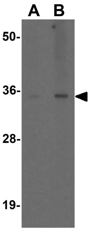 WB analysis of human liver tissue lysate using GTX17222 SHBG antibody. Working concentration : (A) 1 and (B) 2 microg/ml WB analysis of human liver tissue lysate using GTX17222 SHBG antibody. Working concentration : (A) 1 and (B) 2 microg/ml