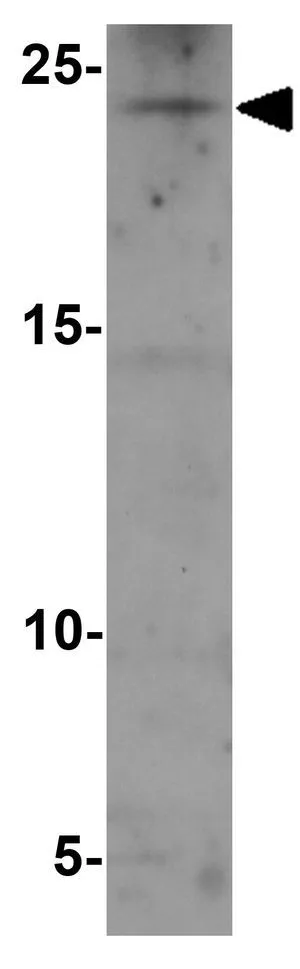 WB analysis of human kidney tissue lysate using GTX17227 RHOG antibody. Working concentration : 1 microg/ml WB analysis of human kidney tissue lysate using GTX17227 RHOG antibody. Working concentration : 1 microg/ml