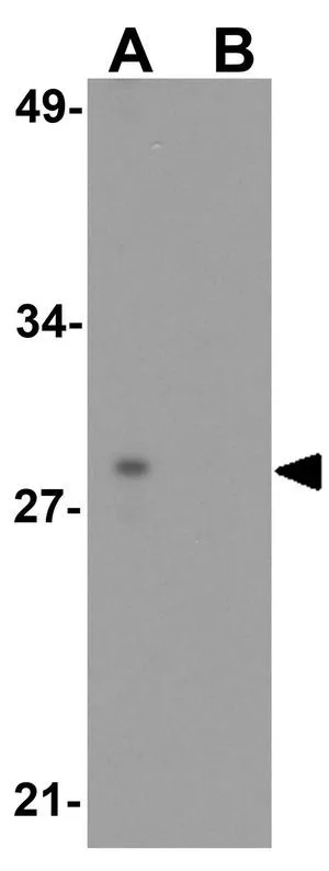 WB analysis of MCF7 cell lysate in (A) the absence and (B) the presence of blocking peptide using GTX17248 RNF121 antibody. Working concentration : 1 microg/ml WB analysis of MCF7 cell lysate in (A) the absence and (B) the presence of blocking peptide using GTX17248 RNF121 antibody. Working concentration : 1 microg/ml