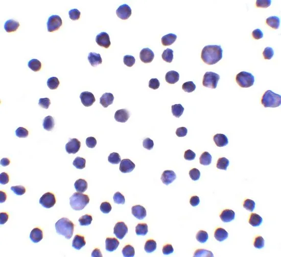 ICC/IF analysis of MCF7 cells using GTX17248 RNF121 antibody. Working concentration : 10 microg/ml