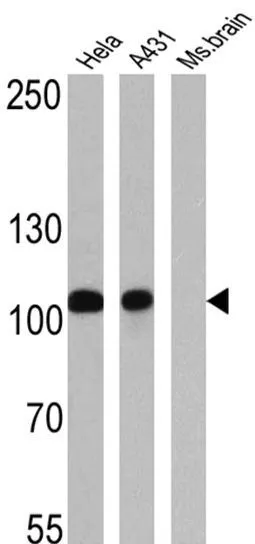 WB analysis of 25 ug of Hela (lane 1), A431 (lane 2) and mouse brain (lane 3) using GTX17259 alpha Catenin antibody [1G5]. Dilution : 1:500