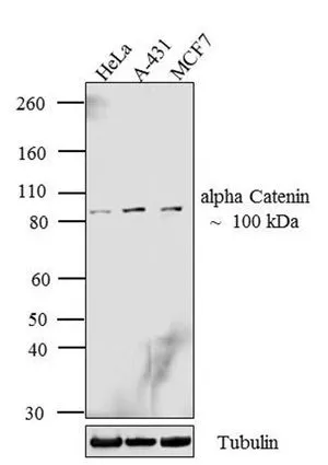 WB analysis of whole cell extracts (30 microg lysate) of HeLa (Lane 1), A-431 (Lane 2) and MCF7 (Lane 3) using GTX17259 alpha Catenin antibody [1G5]. Dilution : 1:250-1:750