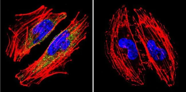 ICC/IF analysis of A2058 Cells using GTX17259 alpha Catenin antibody [1G5]. Cells were probed without (right) or with(left) an antibody. Green : Primary antibody Blue : Nuclei Red : Actin Fixation : formaldehyde Dilution : 1:20 overnight at 4oC