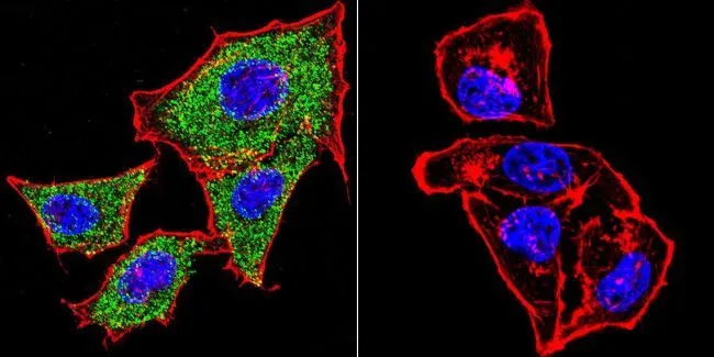 ICC/IF analysis of HeLa cells using GTX17259 alpha Catenin antibody [1G5]. Cells were probed without (right) or with(left) an antibody. Green : Primary antibody Blue : Nuclei Red : Actin Fixation : formaldehyde Dilution : 1:20 overnight at 4oC