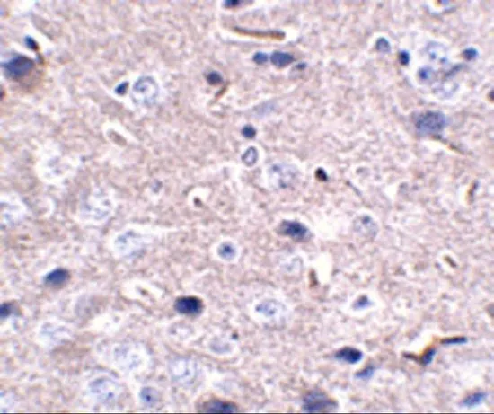 IHC-P analysis of mouse brain tissue using GTX17273 PD1 antibody [12A7D7]. Working concentration : 2.5 microg/ml