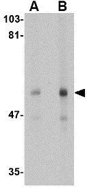 WB analysis of human thymus tissue lysate using GTX17277 CD4 antibody [9H5A8]. Working concentration : (A) 0.5 and (B) 1 ug/ml