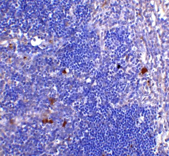 IHC-P analysis of human thymus tissue using GTX17283 CD4 antibody [8G1B12]. Working concentration : 5 microg/ml