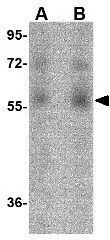 WB analysis of human ovary tissue lysate using GTX17287 Orai1 antibody [3F6H5]. Working concentration : (A) 1 and (B) 2 microg/ml
