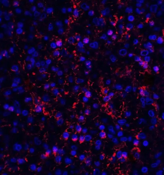 IHC-P analysis of human spleen tissue using GTX17287 Orai1 antibody [3F6H5]. Working concentration : 20 microg/ml