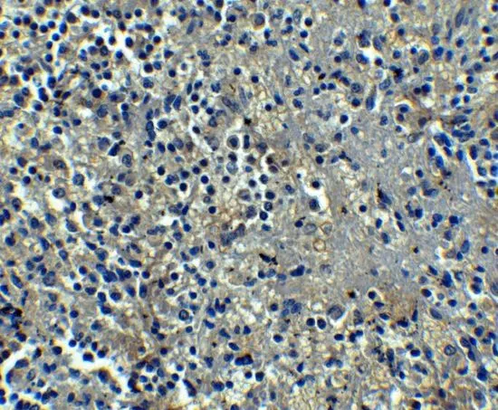IHC-P analysis of human spleen tissue using GTX17289 Orai1 antibody [6D11A11]. Working concentration : 5 microg/ml