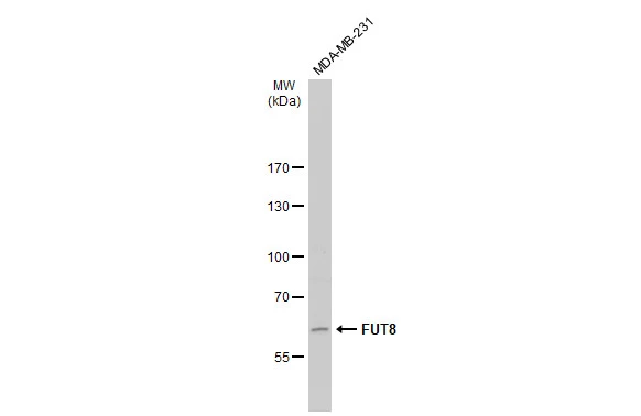 Whole cell extract (30 microg) was separated by 7.5% SDS-PAGE, and the membrane was blotted with FUT8 antibody (GTX17311) diluted at 1:500. The HRP-conjugated anti-rabbit IgG antibody (GTX213110-01) was used to detect the primary antibody, and the signal was developed with Trident femto Western HRP Substrate.