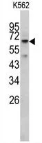 WB analysis of K562 cell lysate (35ug/lane) using GTX17382 RIOK1 antibody.