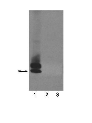 WB analysis of Amyloid beta polypeptides using GTX17420 beta Amyloid (1-40) antibody [4H308].<br>Lane 1 : amyloid b1-40<br>Lane 2 : amyloid b1-42<br>Lane 3 : amyloid b1-43<br>Dilution : 1:1000