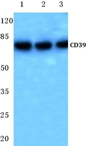 Western blot (WB) analysis of CD39 polyclonal antibody at 1:500 dilution. Lane1: HK-2 whole cell lysate (40ug) Lane2: HEK293T whole cell lysate (20ug) Western blot (WB) analysis of CD39 polyclonal antibody at 1:500 dilution. Lane1: HK-2 whole cell lysate (40ug) Lane2: HEK293T whole cell lysate (20ug)