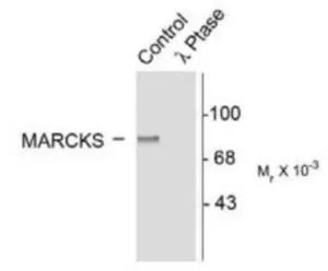 WB analysis of lambda-phosphatase treated or un-treated rat brain tissue lysate using GTX17544 MARCKS (phospho Ser152/Ser156) antibody.