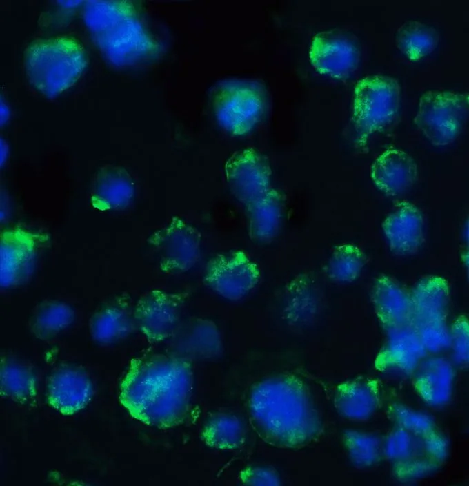 ICC/IF analysis of 3T3 cells using GTX17545 BACE1 antibody. Dilution : 20 microg/ml