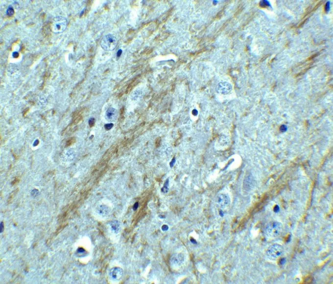 IHC-P analysis of mouse brain tissue using GTX17545 BACE1 antibody. Dilution : 2.5 microg/ml