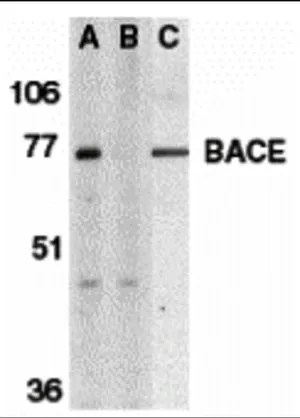 WB analysis of human brain tissue lysate in the absence (A) or presence (B) of blocking peptide and in mouse 3T3 cell lysate (C) using GTX17545 BACE1 antibody. Dilution : 1 microg/mL