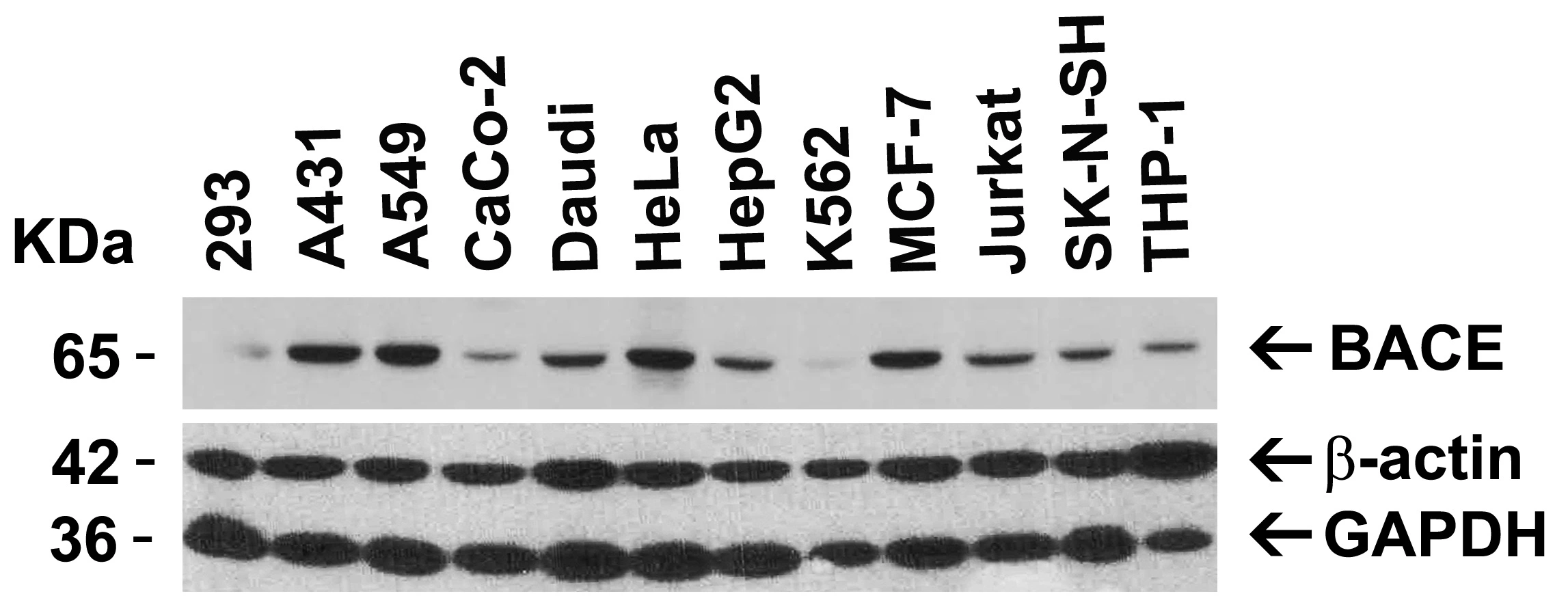 WB analysis of various sample lysates using GTX17545 BACE1 antibody. Loading : 15microg of lysates per lane Dilution : 1 microg/ml