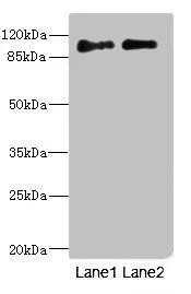 WB analysis of HepG2(Lane 1) and A549(Lane 2) lysates using GTX17563 ICAM5 antibody. WB analysis of HepG2(Lane 1) and A549(Lane 2) lysates using GTX17563 ICAM5 antibody.