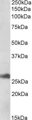 WB analysis of human liver tissue lysate using GTX17566 DNAJB9 antibody. Loading : 35microg WB analysis of human liver tissue lysate using GTX17566 DNAJB9 antibody. Loading : 35microg