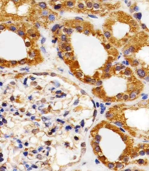 IHC-P analysis of human kidney tissue section using GTX17567 VEGF Receptor 3 antibody [818CT12.1.1]. Dilution : 1:25