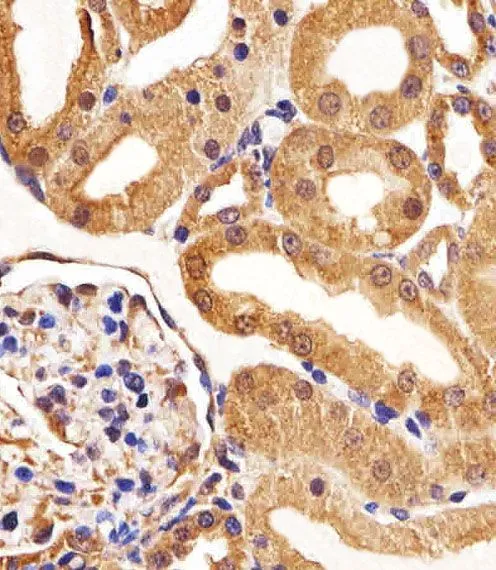 IHC-P analysis of rat kidney tissue section using GTX17567 VEGF Receptor 3 antibody [818CT12.1.1]. Dilution : 1:25