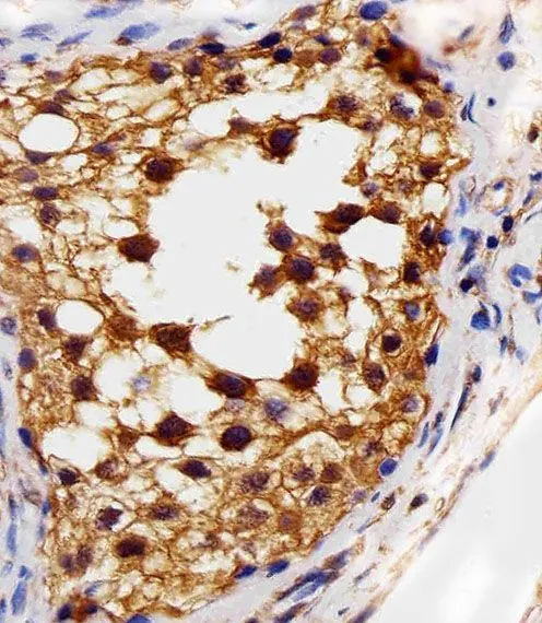 IHC-P analysis of human testis tissue section using GTX17567 VEGF Receptor 3 antibody [818CT12.1.1]. Dilution : 1:25
