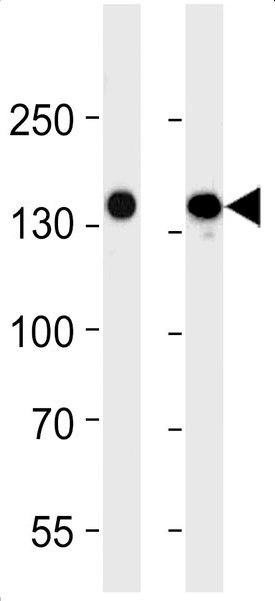 WB analysis of various samples using GTX17567 VEGF Receptor 3 antibody [818CT12.1.1]. Lane 1 : 293 whole cell lysate Lane 2 : A549 whole cell lysate Loading : 35microg per lane
