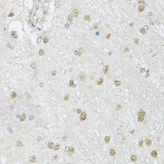 IHC-P analysis of mouse brain tissue using GTX17569 CMAS antibody. Dilution : 1:150