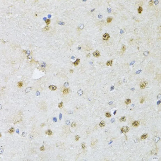 IHC-P analysis of rat brain tissue using GTX17569 CMAS antibody. Dilution : 1:150