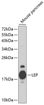 WB analysis of mouse pancreas tissue lysate using GTX17573 Leptin antibody. Dilution : 1:1000 Loading : 25ug