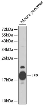 WB analysis of mouse pancreas tissue lysate using GTX17573 Leptin antibody. Dilution : 1:1000 Loading : 25microg per lane WB analysis of mouse pancreas tissue lysate using GTX17573 Leptin antibody. Dilution : 1:1000 Loading : 25microg per lane
