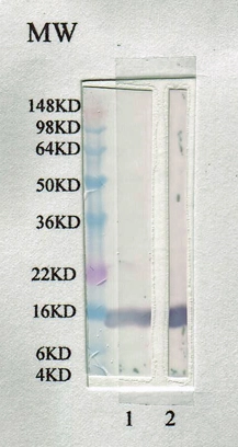 Western blot analysis of rat leptin with 1) GTX17629 rabbit anti rat leptin at 1:2000 and 2) GTX17531 chicken anti rat leptin at 1:2000 Western blot analysis of rat leptin with 1) GTX17629 rabbit anti rat leptin at 1:2000 and 2) GTX17531 chicken anti rat leptin at 1:2000