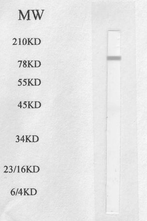 Western blot analysis using mouse epididymal fat cell lysate Western blot analysis using mouse epididymal fat cell lysate