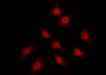 ICC/IF analysis of PFA-fixed HeLa cells using GTX17677 HSP27 (phospho Ser82) antibody. Permeabilization : 0.1% Triton X-100 Dilution : 1:200