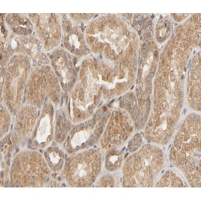 IHC-P analysis of human kidney tissue sections using GTX17677 HSP27 (phospho Ser82) antibody. Antigen retrieval : Heat mediated antigen retrieval in citrate buffer Dilution : 1:200