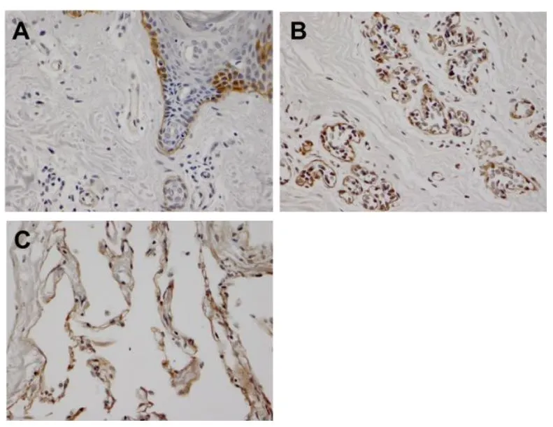 IHC-P analysis of various tissue samples using GTX17685 Laminin alpha 3A antibody [BG5]. Figure A : Normal skin tissue (paraffin slice) Figure B : Normal mammary gland (paraffin slice) Figure C : Normal lung tissue (paraffin slice)