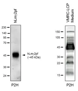 WB analysis of various samples using GTX17686 Laminin gamma 2 chain (N-terminal region) antibody [P2H]. Small gamma 2 N-terminal fragments are seen below the gamma 2pf band (45 kDa), and 15-kDa bands corresponds to NE1-2 and NE2-3. Left : recombinant human gamma 2pf under reducing conditions, 10% gel Right : conditioned medium of VMRC-LCP lung cancer cells, gradient gel Dilution : 1:1000