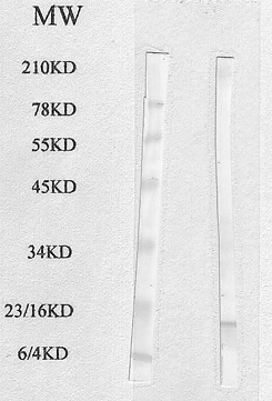 Western blot analysis using mouse epididymal fat cell lysate Western blot analysis using mouse epididymal fat cell lysate