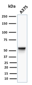 WB analysis of A375 cell lysate using GTX17723 Vimentin antibody [VM452].