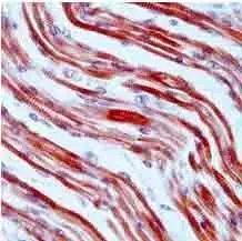 Human heart stained with GTX17784 at 1/50 on paraffin sections Human heart stained with GTX17784 at 1/50 on paraffin sections
