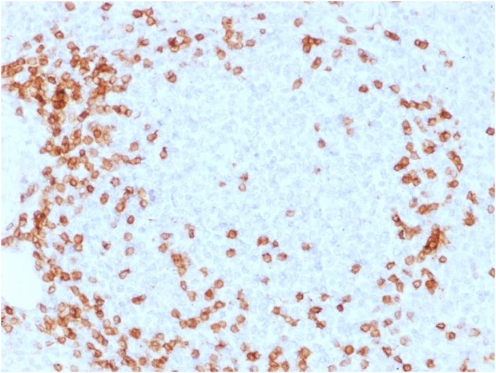 IHC-P analysis of human spleen tissue using GTX17861 CD3 epsilon antibody [C3e/1931].