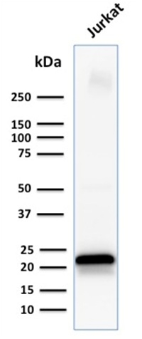 WB analysis of Jurkat cell lysate using GTX17861 CD3 epsilon antibody [C3e/1931].
