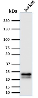 WB analysis of Jurkat cell lysate using GTX17864 CD3 epsilon antibody [C3e/2478].