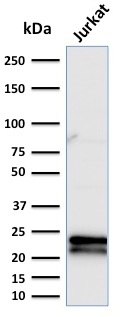 WB analysis of Jurkat cell lysate using GTX17865 CD3 epsilon antibody [C3e/2479].