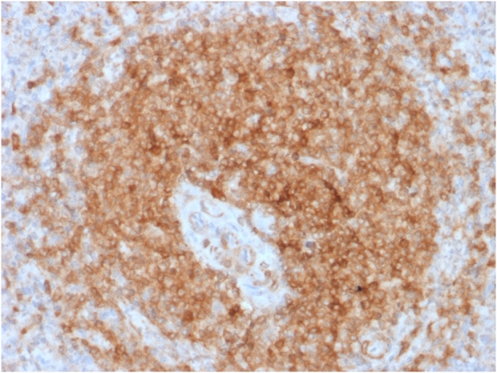 IHC-P analysis of human spleen tissue using GTX17887 CD79a antibody [rIGA/764].